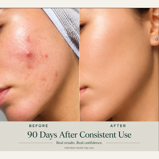 Skin Renewal Complete Bundle